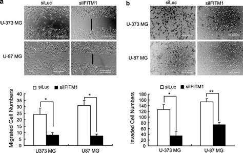 Effect Of Ifitm1 Knockdown On Glioma Cell Migration And Invasion