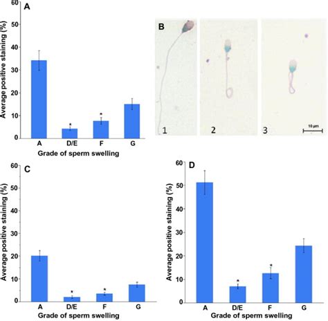 Hypo Osmotic Swelling Test Identifies Individual Spermatozoa With