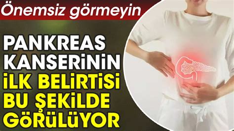 Pankreas kanserinin ilk belirtisi bu şekilde görülüyor Pankreas