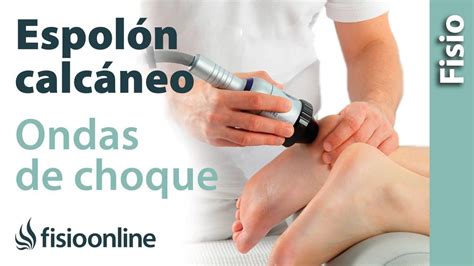 Espolón Calcáneo y ondas de choque FisioOnline