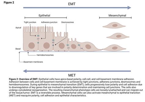 Epithelial Mesenchymal Transition Cancer