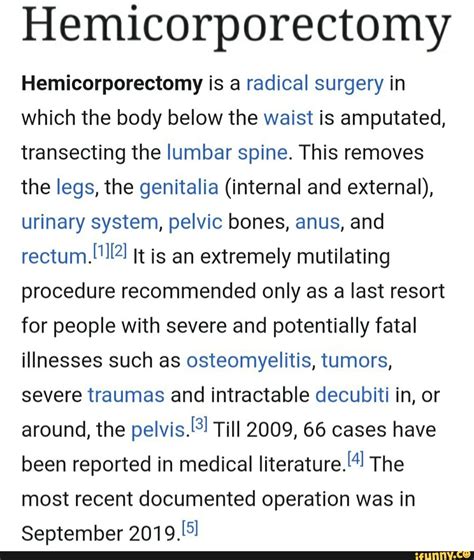 Hemicorporectomy Hemicorporectomy is a radical surgery in which the ...