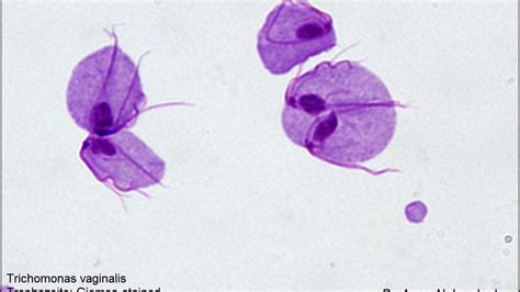 Trichomonas Vaginalis Troph