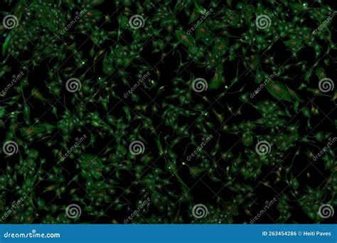 Microfilaments Nuclei And Mitochondria Of Fibroblasts Stock