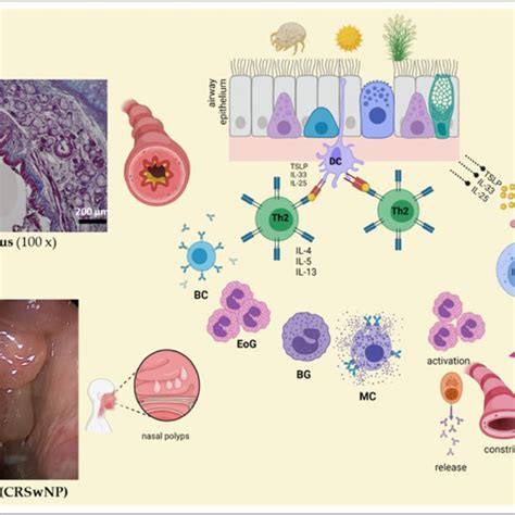 The Influence Of Distinct Triggers On The Airway Epithelium Several