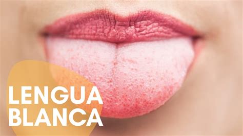 Porq Tengo La Lengua Blanca Shop Dakora Co