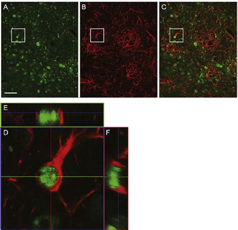 Figure From Viral Vector Mediated Expression Of Mutant Huntingtin In