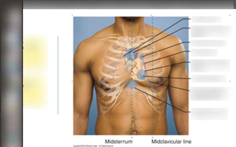 Nurs 115 Exam 3 Diagram Quizlet