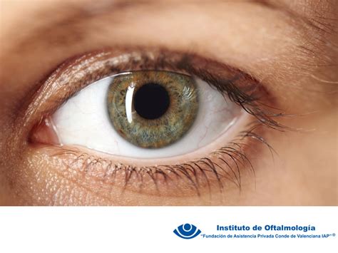 Cirugía de Glaucoma en México TRATAMIENTO PARA RETINOPATÍA DIABÉTICA