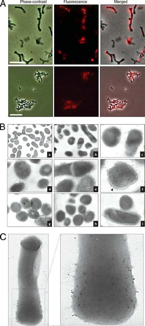 Localization Of The Tgaa Protein In B Bifidum Mimbb Cells By