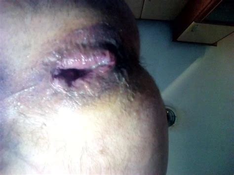 Anusglotom Gay Porn Videos Sex Model Nudes Xhamster