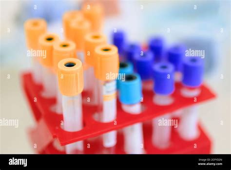 Laboratory Test Tubes In Box Container In Research Lab Blood Tube Test