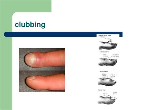 general physical examination powerpoint  id