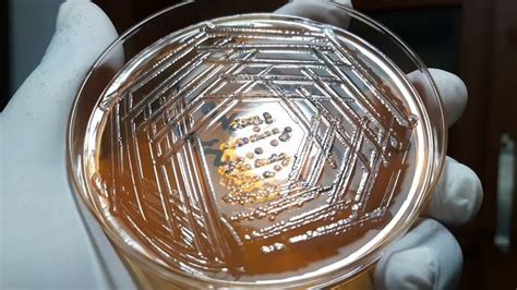 Proteus mirabilis colony characteristics on Macconkey medium | Proteus mirabilis, Microbiology ...