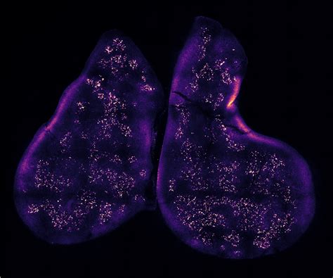 Boot Camp for the Immune System | Harvard Medical School