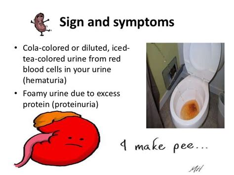 Glomerulonephritis Signs And Symptoms