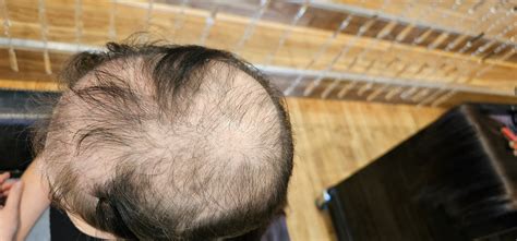 Revolutionize Your Look: Expert Mesh Hair Integration Services in Pert