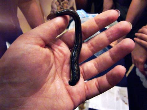 Woman Finds Three Inch Leech Living Up Her Nose · The Daily Edge