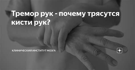 Тремор рук - почему трясутся кисти рук? | Клинический Институт Мозга | Дзен