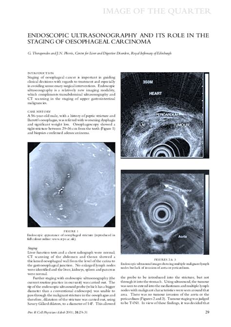 Pdf Trans Endoscopic Ultrasonography Of The Oesophagus And