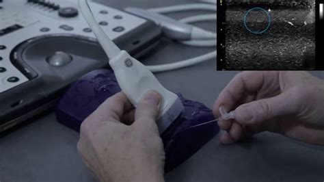 Ultrasound For Peripheral Vascular Access Practical Training Youtube