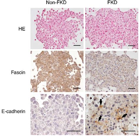 He And Immunohistochemistry Staining Of Non Fkd And Fkd Mda Mb Cell