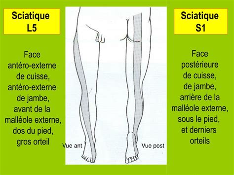 PPT Pathologie péri articulaire membre inférieur PowerPoint