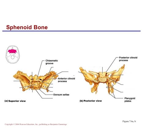 Sphenoid Bone Diagram Quizlet