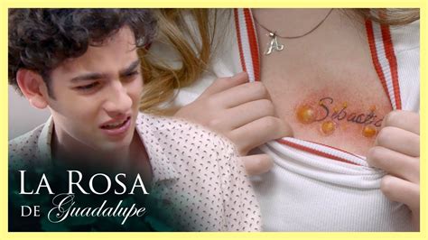 Iv N Siente Asco Al Ver El Tatuaje Infectado De Alondra La Rosa De