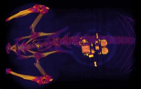 Tiny Implantable Device Uses Light To Treat Bladder Problems