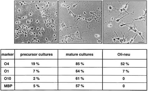 Morphology And Antigen Profile Of Oligodendrocyte Primary Cultures And