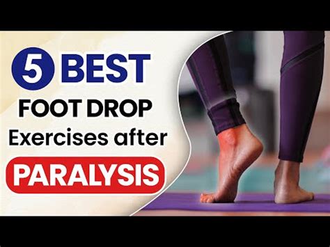 5 Best for Foot Drop Exercises after Paralysis | Foot Drop Exercise ...