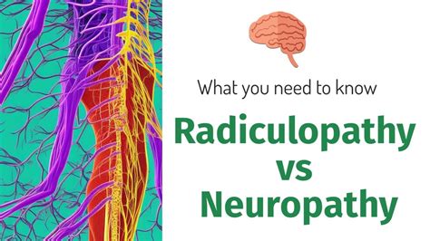 The Difference Between Radiculopathy And Neuropathy What You Need To