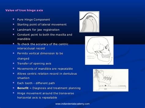 Hinge Axis Certified Fixed Orthodontic Courses By Indian Dental Acad