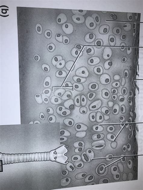 hyaline cartilage Diagram | Quizlet