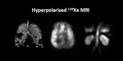 MRI CryoProbes | Small Animal in Vivo Imaging | Manufacturer | Bruker