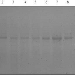 Sds Page Analysis Of The Purified Enzymes Lanes Wild Type D E