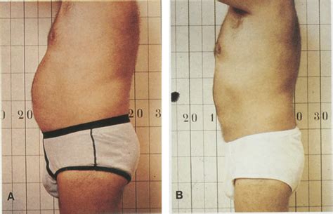Weight Loss Before And After Older Men