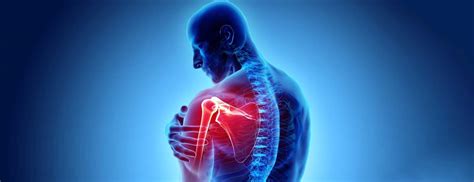 What is Rheumatoid Arthritis in Shoulder: Causes and Treatment