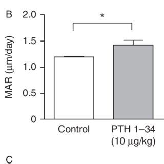 Intermittent Low Dose Pth Increased Expression Of The Osteoblast