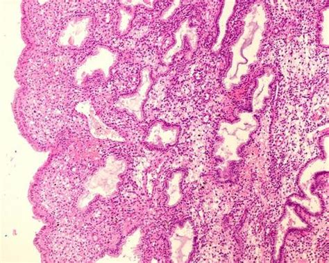 endometrium stock  images  backgrounds