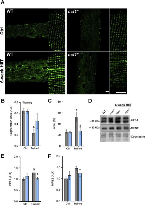 HIIT Induced Changes In Mitochondrial Network Morphology And