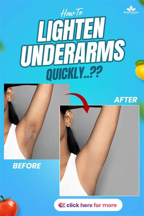 How To Lighten Underarms Using Natural Remedies And Treatment Artofit