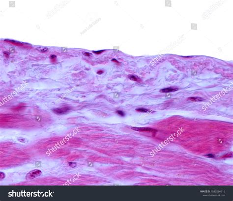 Endothelium Slide