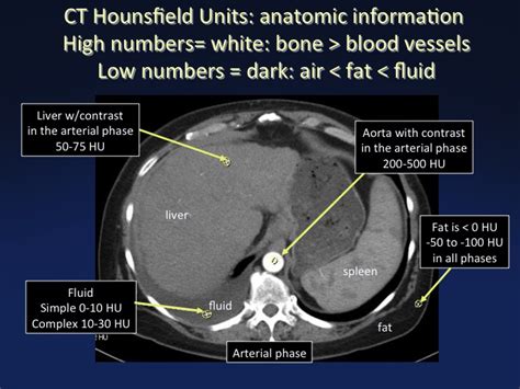 Cross Sectional Anatomy Of The Body Mdct Atlas Ct Scanning