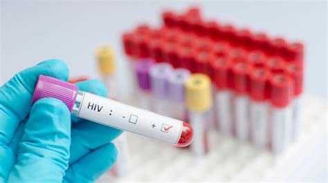 Hiv Cure Second Hiv Patient Cured But Experimental Operation Has Risk