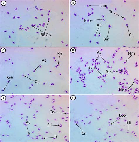 Representative Hematoxylineosin Stained Blood Smears Collected From