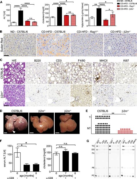 Cd T Cells And Nkt Cells Control Liver Damage Nash And Hcc In A