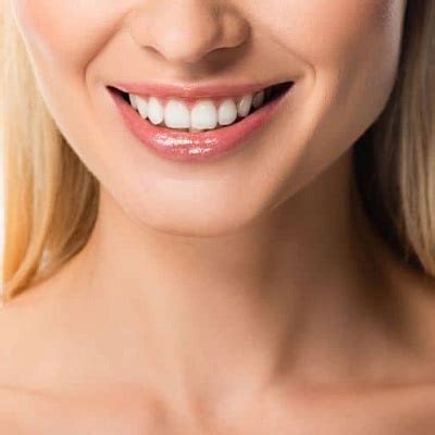 Get Ready To Shine Teeth Whitening Solutions In Islamabad Theamberpost