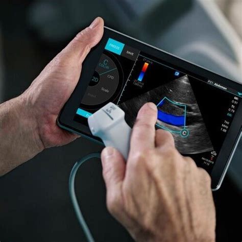 Focused Cardiac Ultrasound Point Of Care Ultrasound